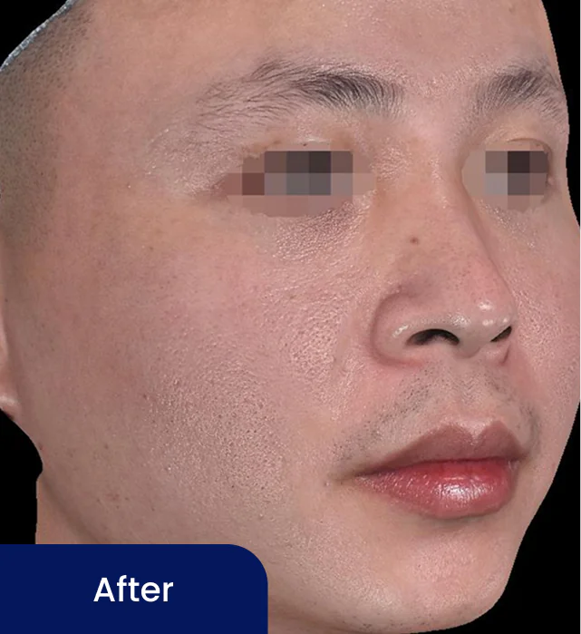 After 2